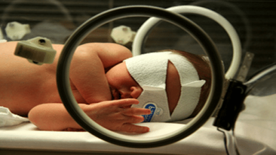مرض الصفراء عند حديثي الولادة وعلاجة بالشرح والفيديو